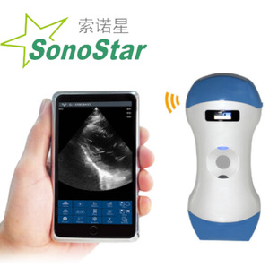 Sonostar�S��ֱ�N ����һ����B��̽�^���Q���ڿ��N�ƶ���ԃ�Ά��r