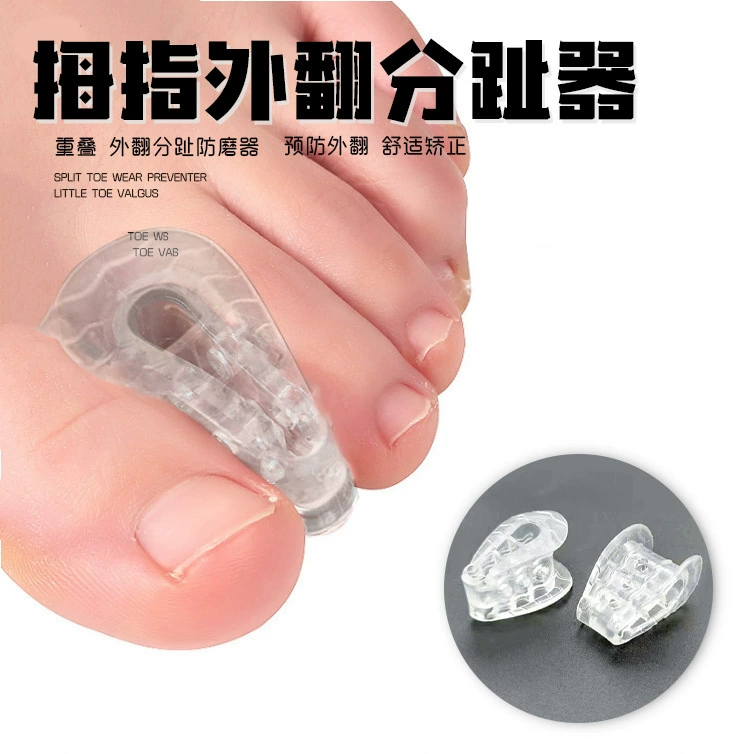 Toe divided toe, thumb overlap, overlapping separator Large bone crantern clip toe pad