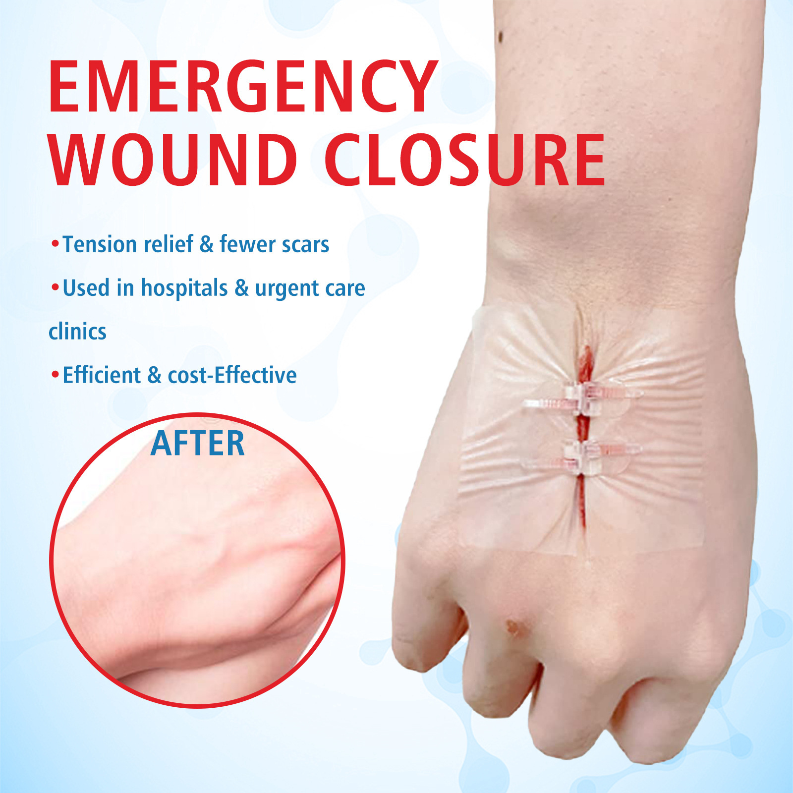 South Moon suturfrit lukkeplaster, suturfrit plaster, hudsårplejeplaster_voghion.com