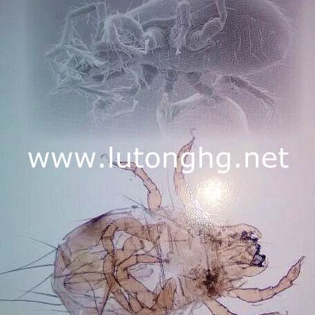 ���Ϸ�ù��³�����ù������RUCO-BAC CID����ԡ��ר��