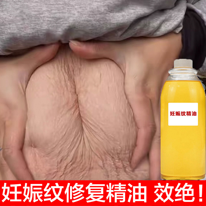 Stretch Mark Removal, Repair and Firming Oil, Special Beauty Salon Care for Postpartum Pregnant Women, Dilution of Growth Lines and Obesity Lines Essential Oil