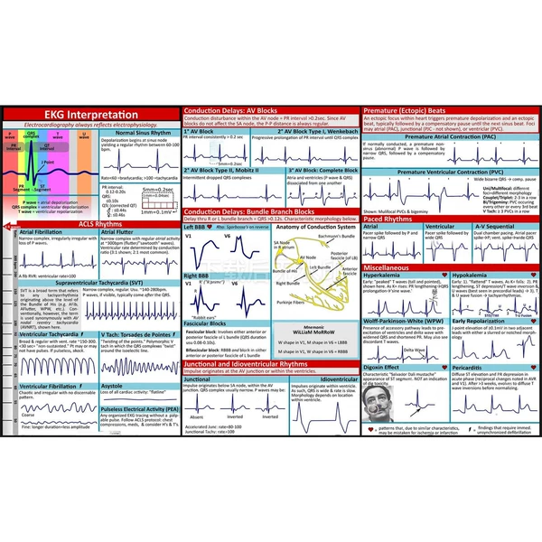 Pocket Guide to EKG