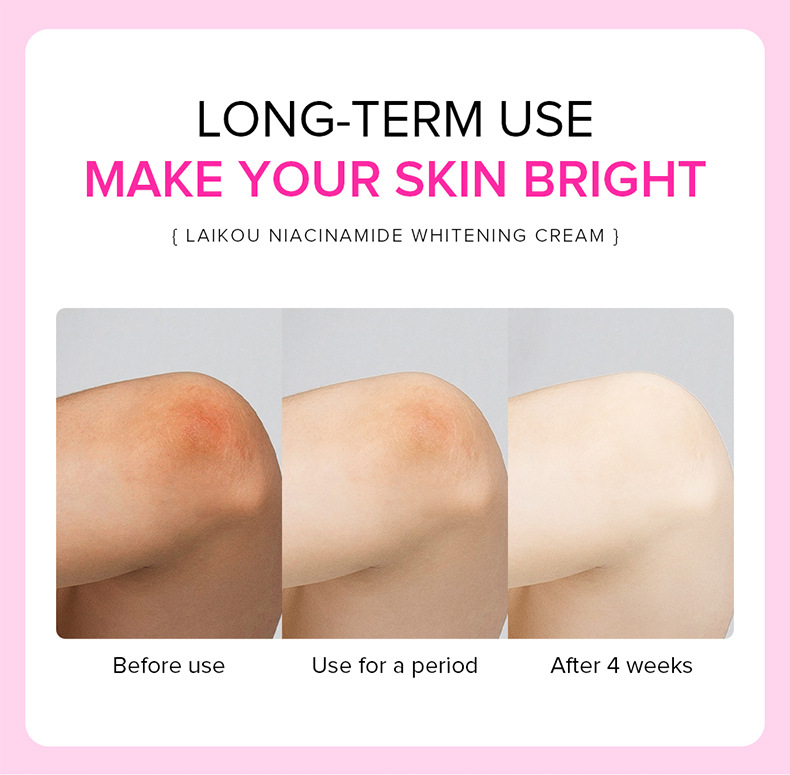 LAIKOU cream 100g Hydrating and moisturizing Underarm Cream Facial skin care products cross-border undefined