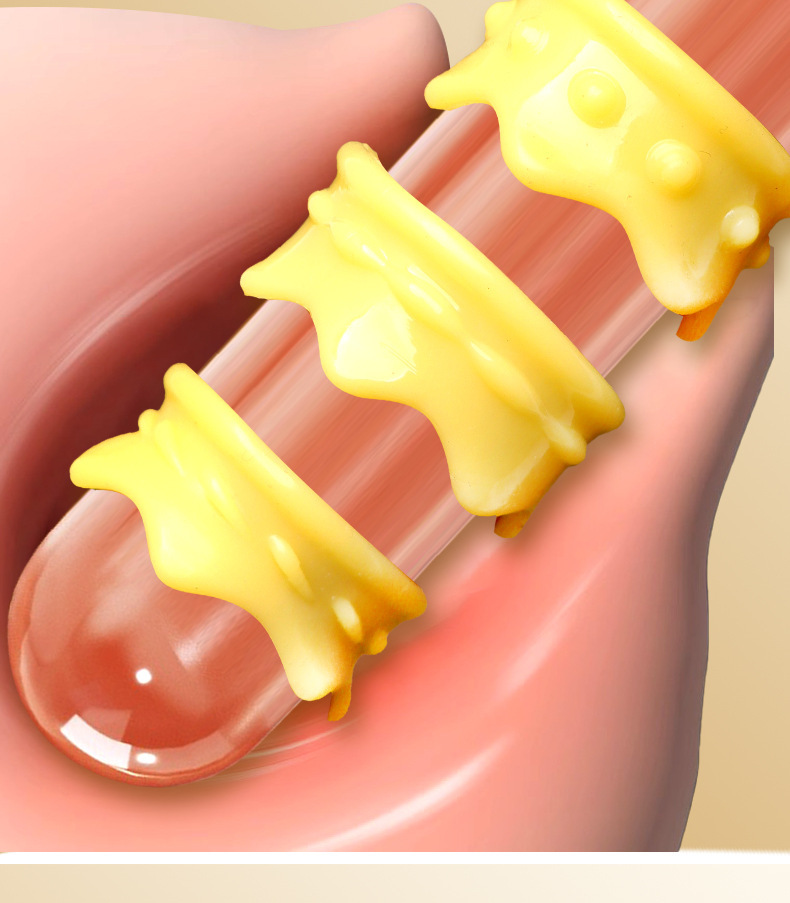 Crown Lock Sperm Ring, TPE Foreskin Barrier Ring, Physical Delay Penis Ring, Yellow — detail image 9