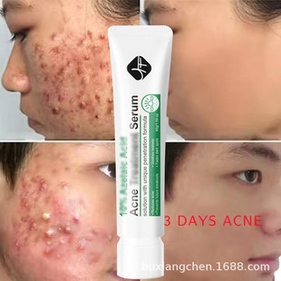 �羳Azelaic acid�ɶ�������A���z�沿ˮ�����]�ڷ۴̵�����ӡ