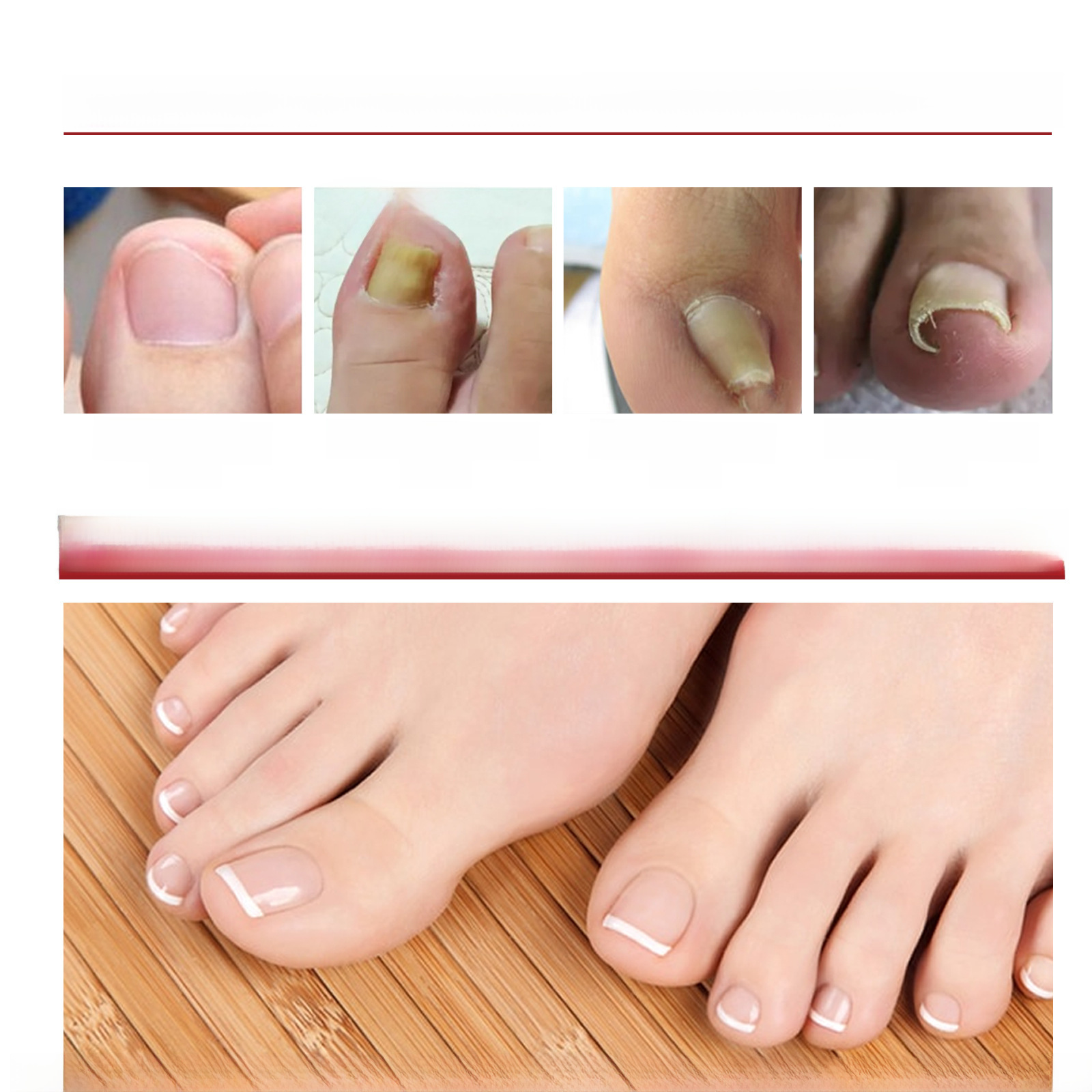 Jaysuing Anti-Skiin Nail Oil for Relief, Softening, Shining, Repairing, Embedding, Thickening and Fungal Nail Care