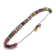 ˮ��ʯ�A�����ֹ�������� ���������L�ִ���羳������Q؛Դ