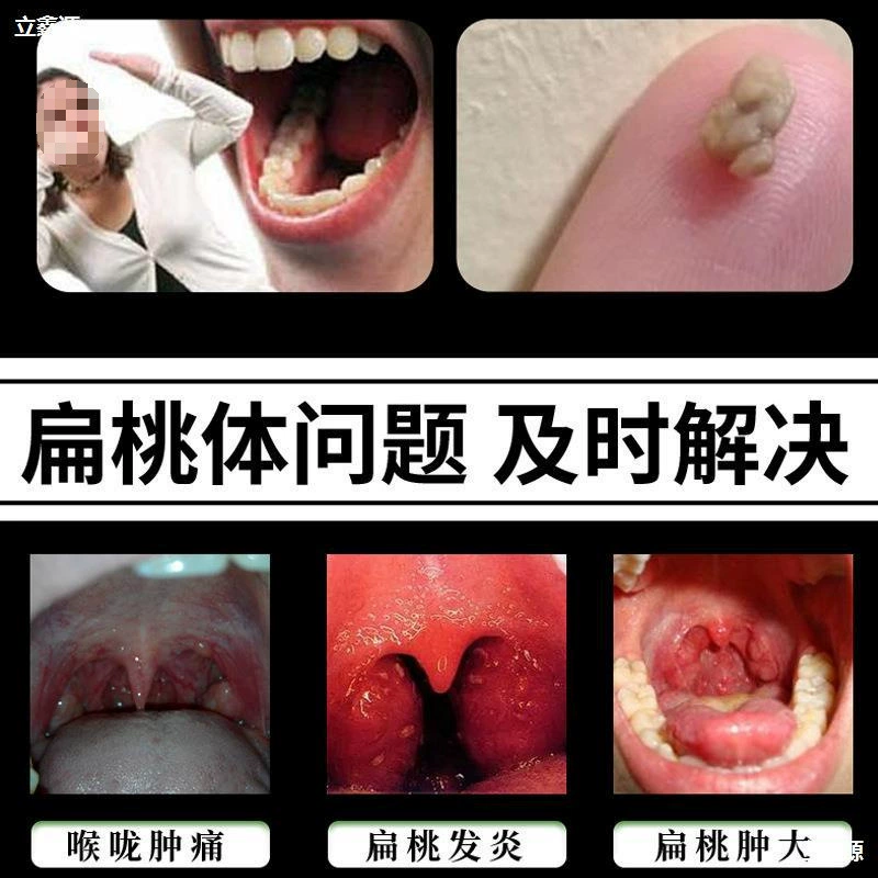 Инструмент для удаления камней в миндалинах с неприятным запахом во рту