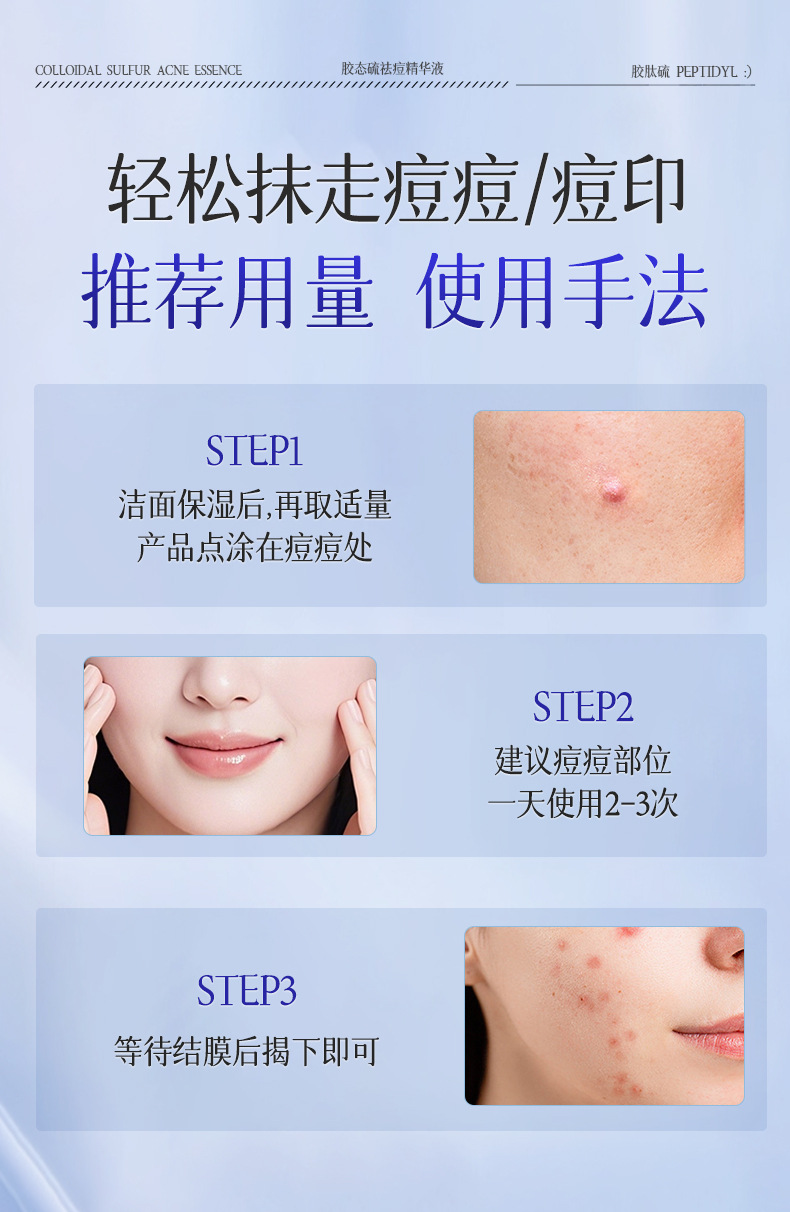 AOPY Colloidal Sulfur Acne-Fighting Essence Effective Acne Removal Improves Acne-Prone Skin Reduces Pimples and Blackheads Salicylic Acid Acne-Treating Liquid