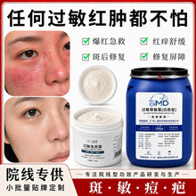 激素脸修护霜止痒修护敏感退红退敏修护屏障增厚角质舒缓肌肤面霜