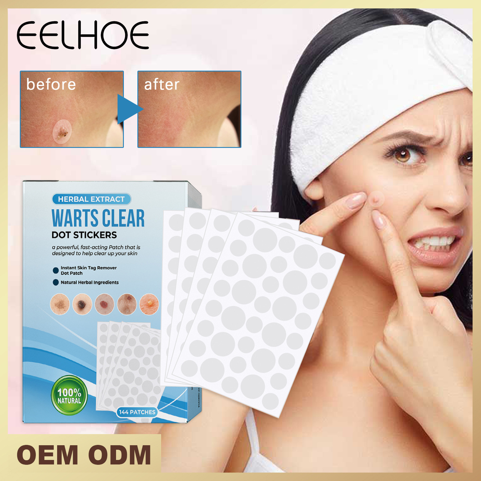 EELHOE Elimineringsplåster för hud Black Memory Curt, Chicken Eyes, Scorpions, Scarless Nevus Cocoon Cleaning and Repair_voghion.com