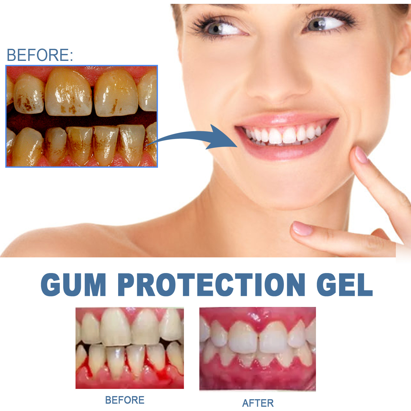 Teeth Repair Gel Image 11