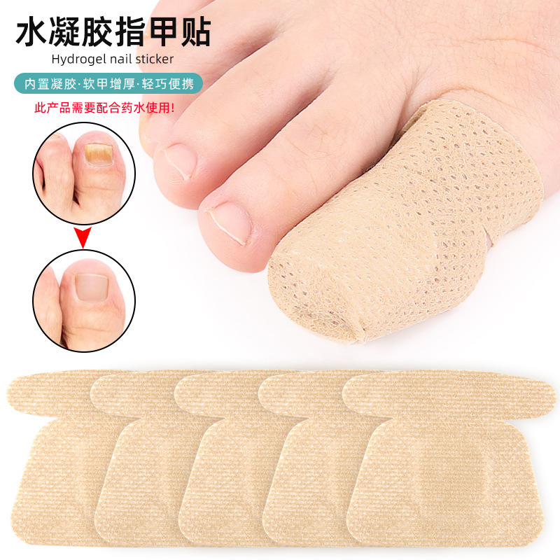 Soft Nail Water Gray Nail Nail Patch Care Ingrown Nail Groove Gel Toenail Repair Thickening Patch Amazon