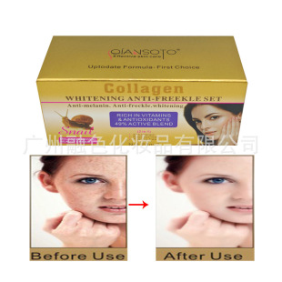 �羳Ӣ����QIANSOTO΁ţ����˪͸���p��Ę��ɫ����˪frecklecream
