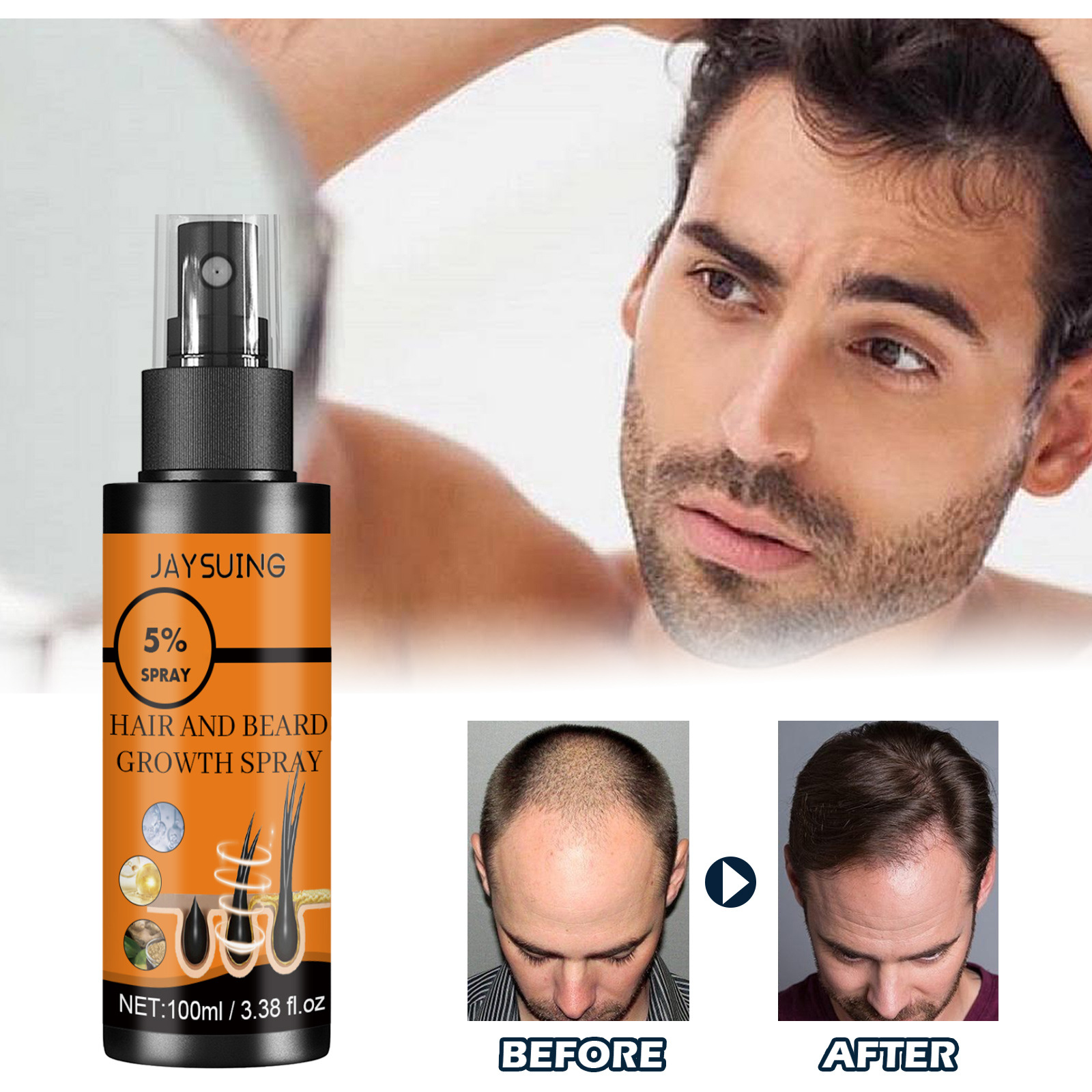 für Jayswing Spray Herrenbart Dickpflege-Fluid zur Stärkung und Vorbeugung von Haarausfall_voghion.com