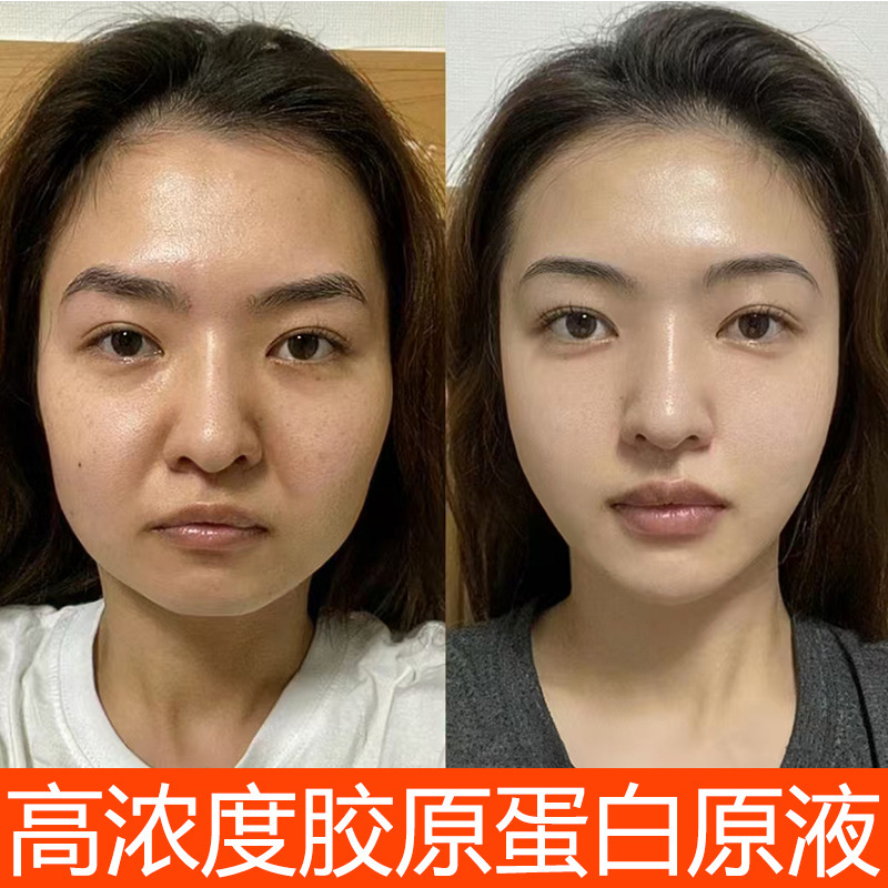Type 3 Collagen Original Solution to Supplement Facial Lifting, Firming, Anti-Wrinkle, Fade Fine Lines, Moisturize, Hydrate, and Anti-Wrinkle Essence