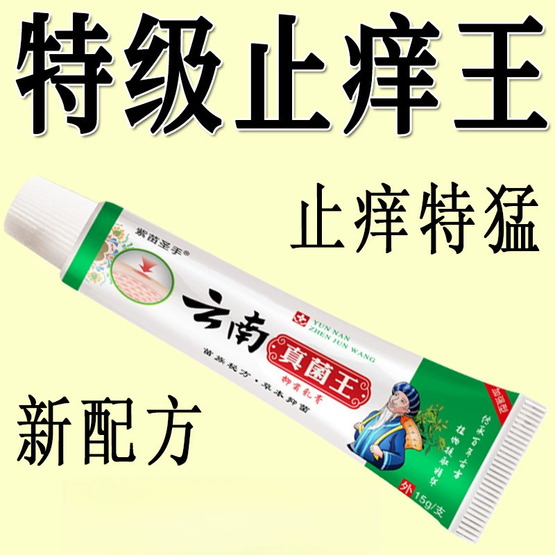 Anti-itch King быстро снимает зуд, наружное применение при зуде кожи, крем против зуда всего тела, специальный антибактериальный эффект при зуде кожи.