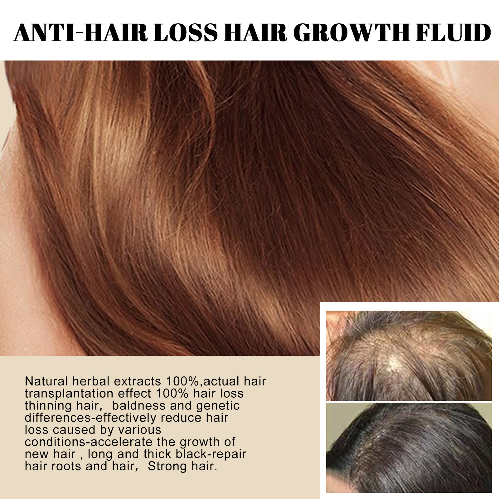 prevention Hair loss solution, growth nutrition, root massage, scalp follicle damage repair, strong and tough_voghion.com