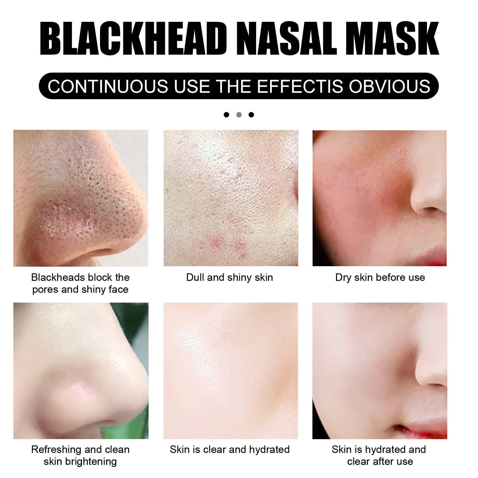 Removal Tearable Nose Mask Gently Cleans Pores Absorbs Blackhead and Acne with 60 Sheets of Paper_voghion.com
