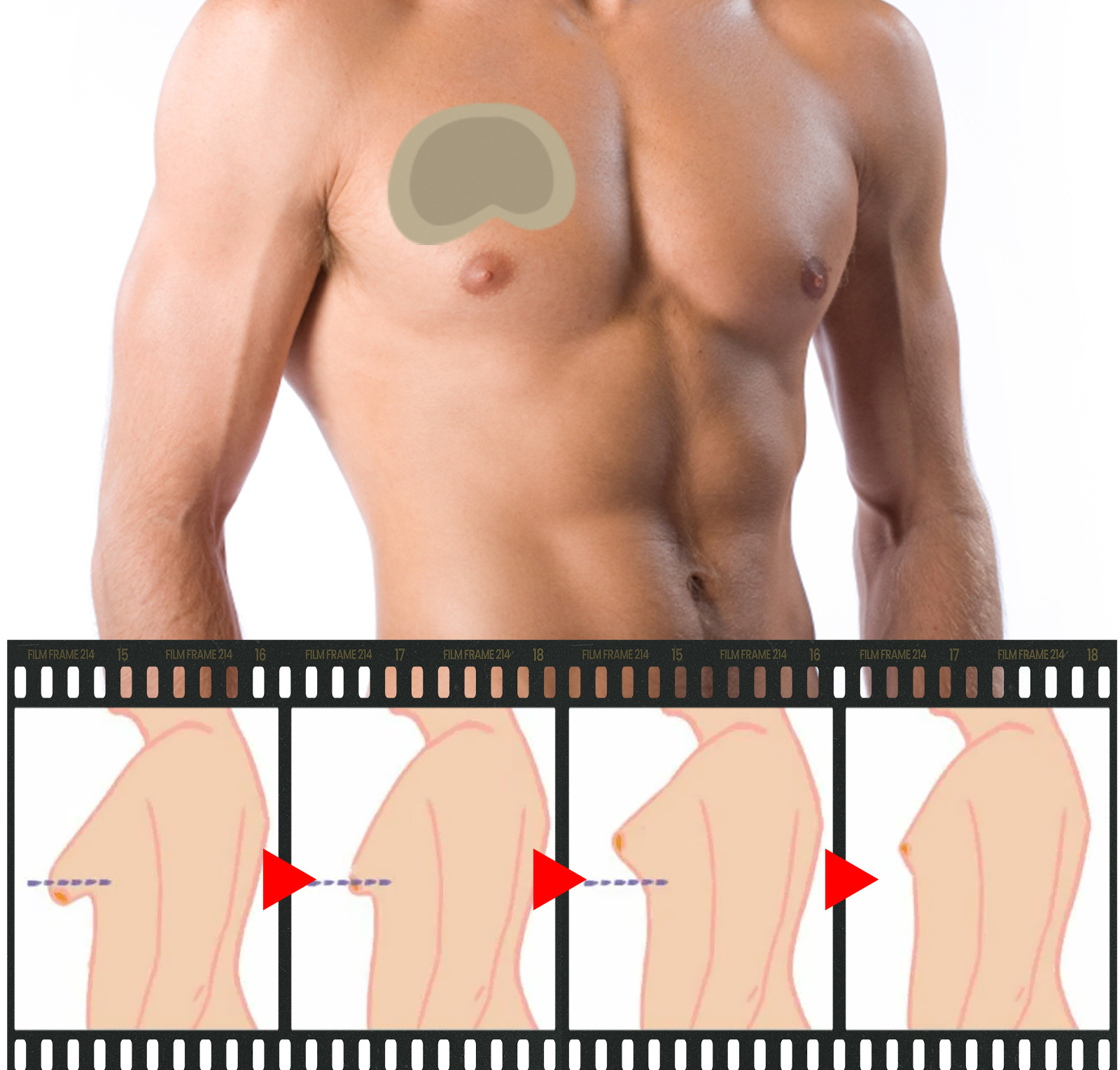 Žolelių Ximonth stangrinančią odą nuo suglebimo krūtinės raumenis formuojantis priežiūros pleistras vyrams Ximonth_voghion.com