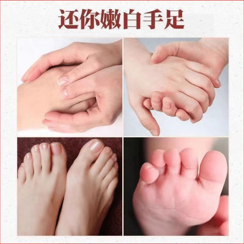 本場雲南の真菌王、かかとの皮むけ、乾燥、ひび割れ、硬い皮、手のひび割れ、ひび割れ防止クリーム|undefined