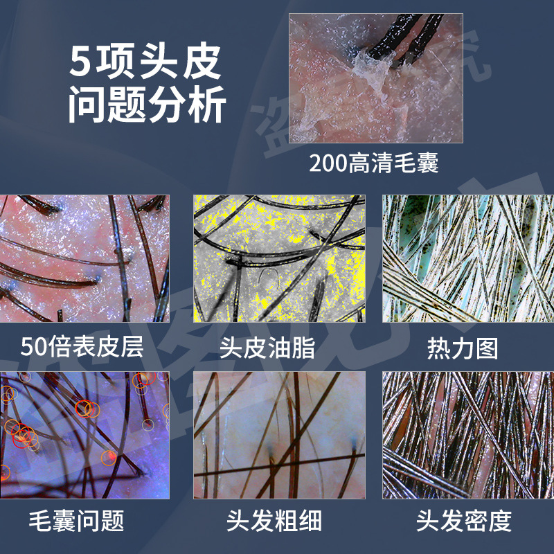 Detector de cuero cabelludo analizador de folículos capilares AI inteligente de alta definición todo en uno aparato de prueba de poros capilares especial para salón de cuidado del cabello