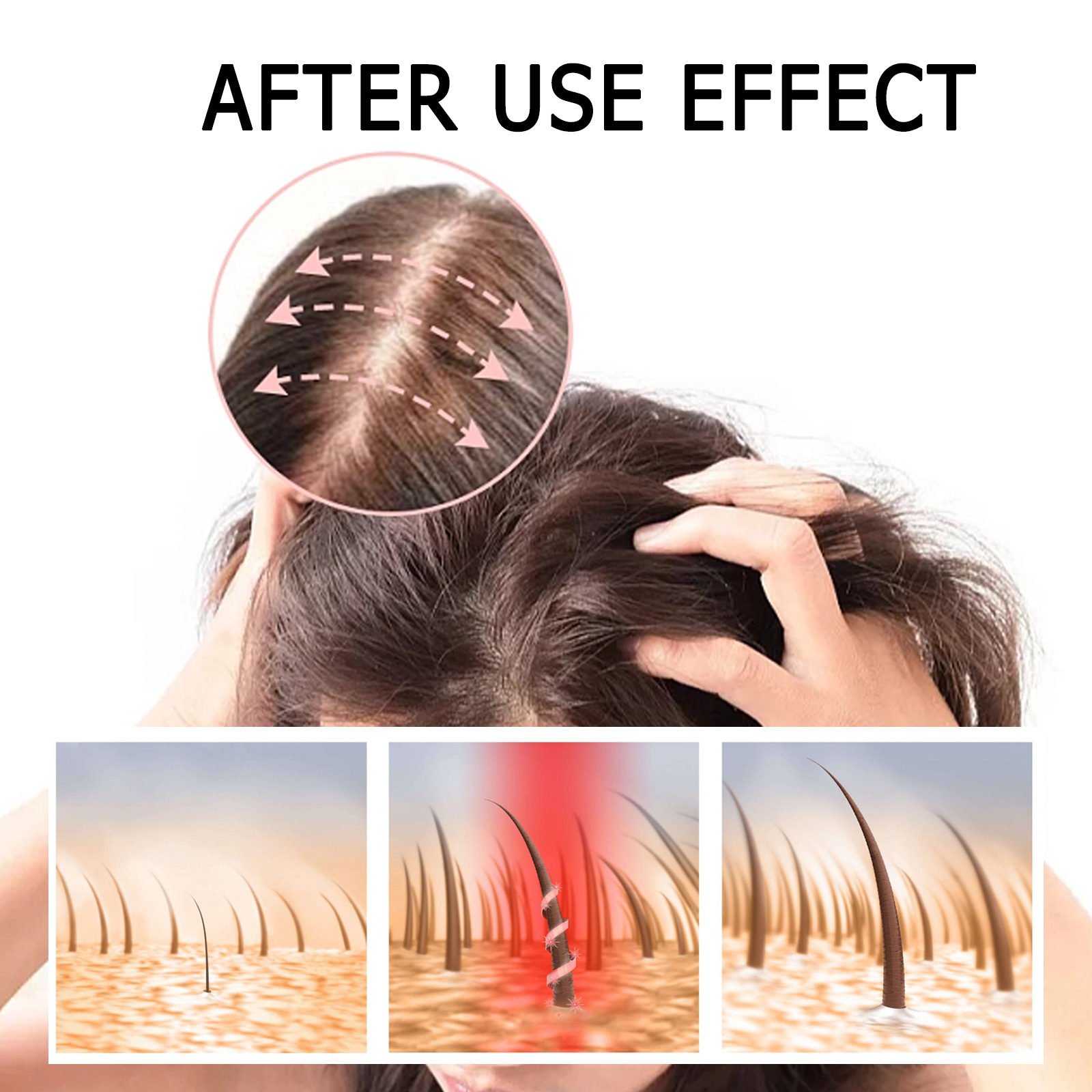 Las cápsulas capilares de jengibre EELHOE nutren las raíces del cabello, nutren y espesan el cabello, fortalecen y previenen la caída del cabello, cuidan el masaje del cuero cabelludo_voghion.com