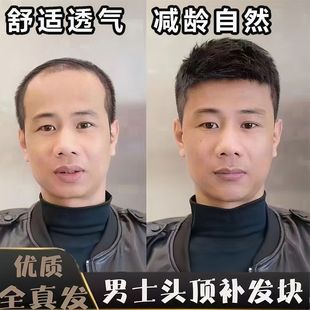 Men's Short Hair Wig, Real Hair, Seamless Invisible Wig, Natural Men's Hair Replacement Piece, Bald Hairstyle