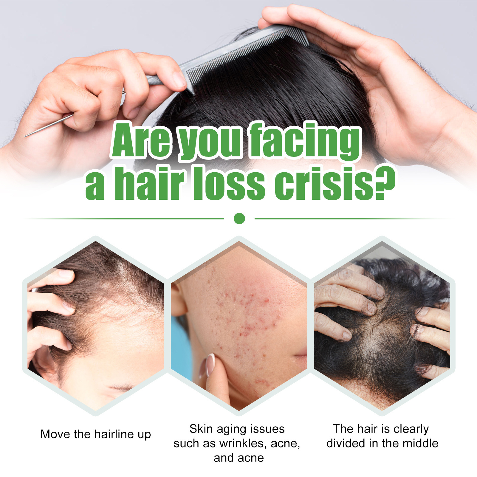 Liquido denso EELHOE Idrata, previene la caduta dei capelli, solidifica, rinforza e rinforza i capelli. Castore Hai._voghion.com