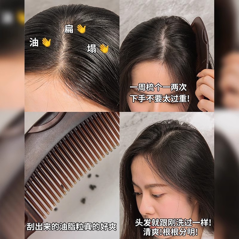 オイルヘッドエナジーコーム、頭皮中空コーム、オイルコントロール、フケ防止、洗い流さないヘアマッサージコーム、油分とフケを除去するクリーニングコーム|undefined