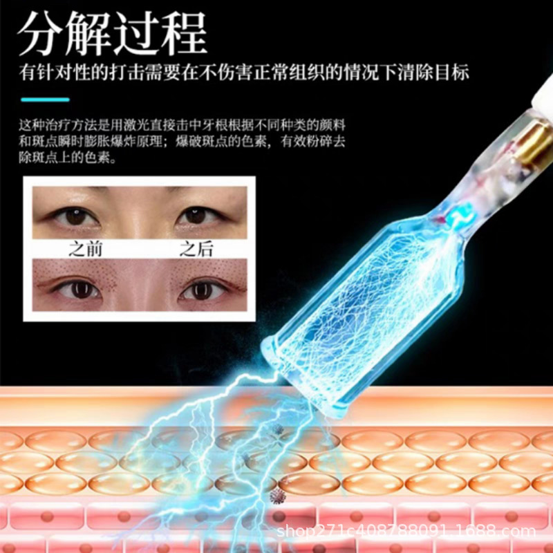 コールドプラズマ美容器、傷跡回復ポイント、ほくろスキャン、ニキビ跡除去、ニキビ穴、顔面導入器、クロスボーダー専用|undefined