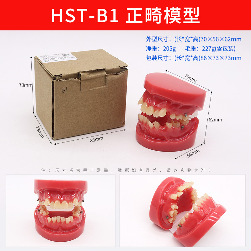 Modelo de ortodoncia dental semi-metal semibrackets Práctica de corrección de molde dental estándar Comunicación médico-paciente Modelo de enseñanza Modelo dental