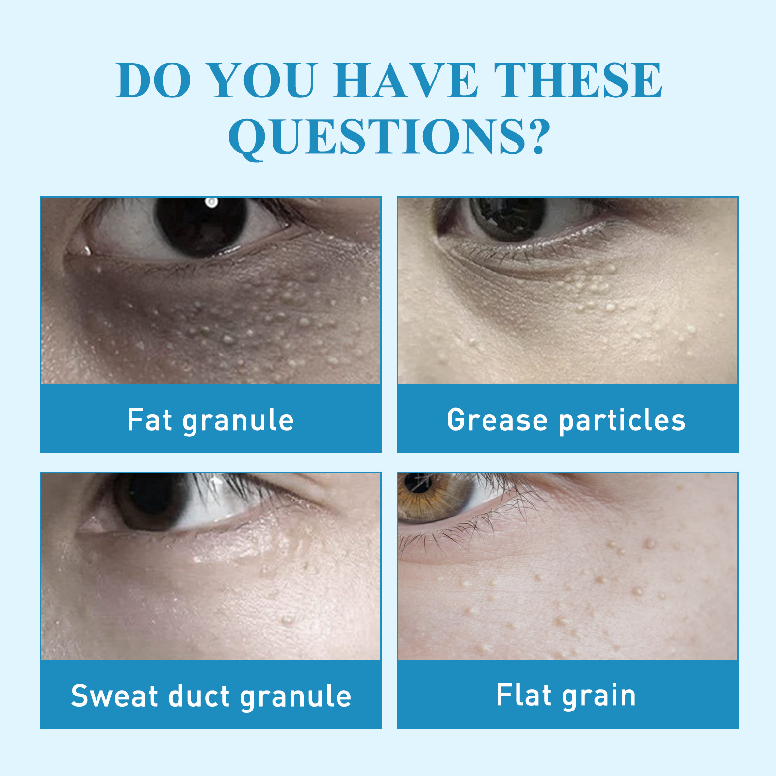 Lõunakuu rasv õligraanulite eemaldamiseks, näo nahaalused massid, tavaline higipiibu graanulite parandav plaaster_voghion.com