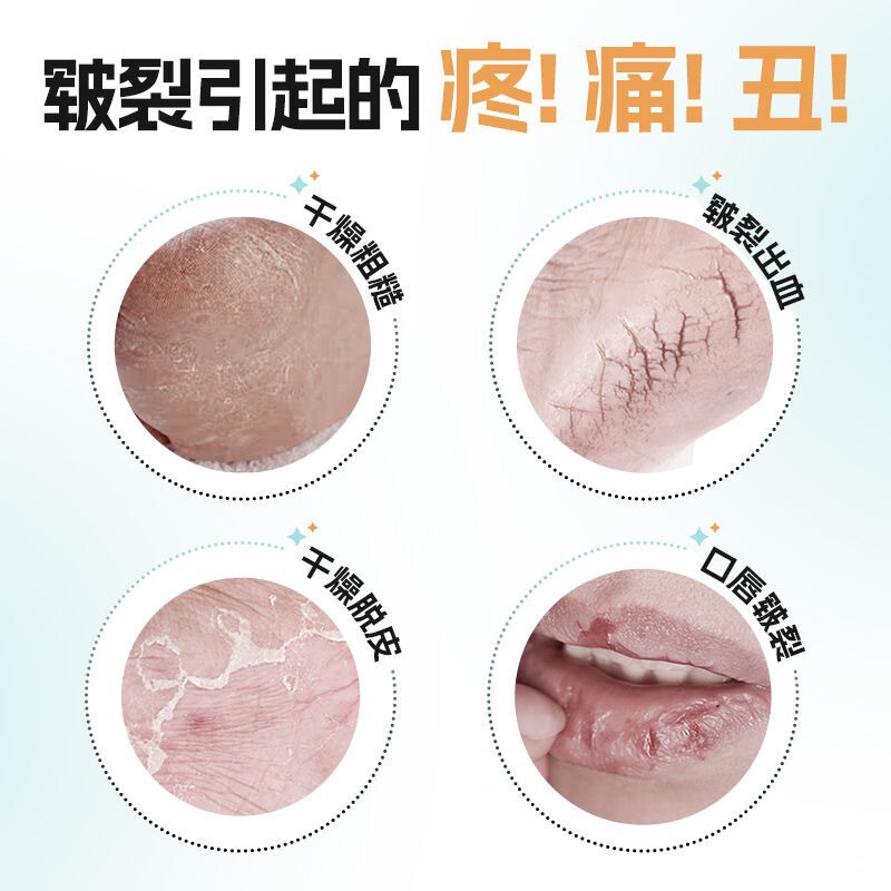 海氏海诺医用白凡士林纯油膏手足面部婴儿润肤润滑剂皮肤防干裂|undefined