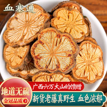 �t����ș�ďV��Ұ����Ѫ��ƬѪͨƬ�t��Ƭ�؎X��Ѫ���ݾ�Ѫ��ͨ