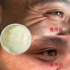 コラーゲン組換えクリームは逆齢で薄められています。