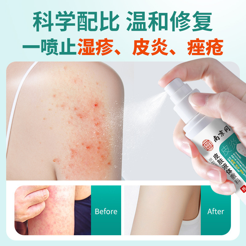 南京同仁堂皮膚かゆみ止めスプレー、皮膚液体包帯、乾燥、ニキビ、落屑の修復、陰部かゆみ止めクリーム|undefined