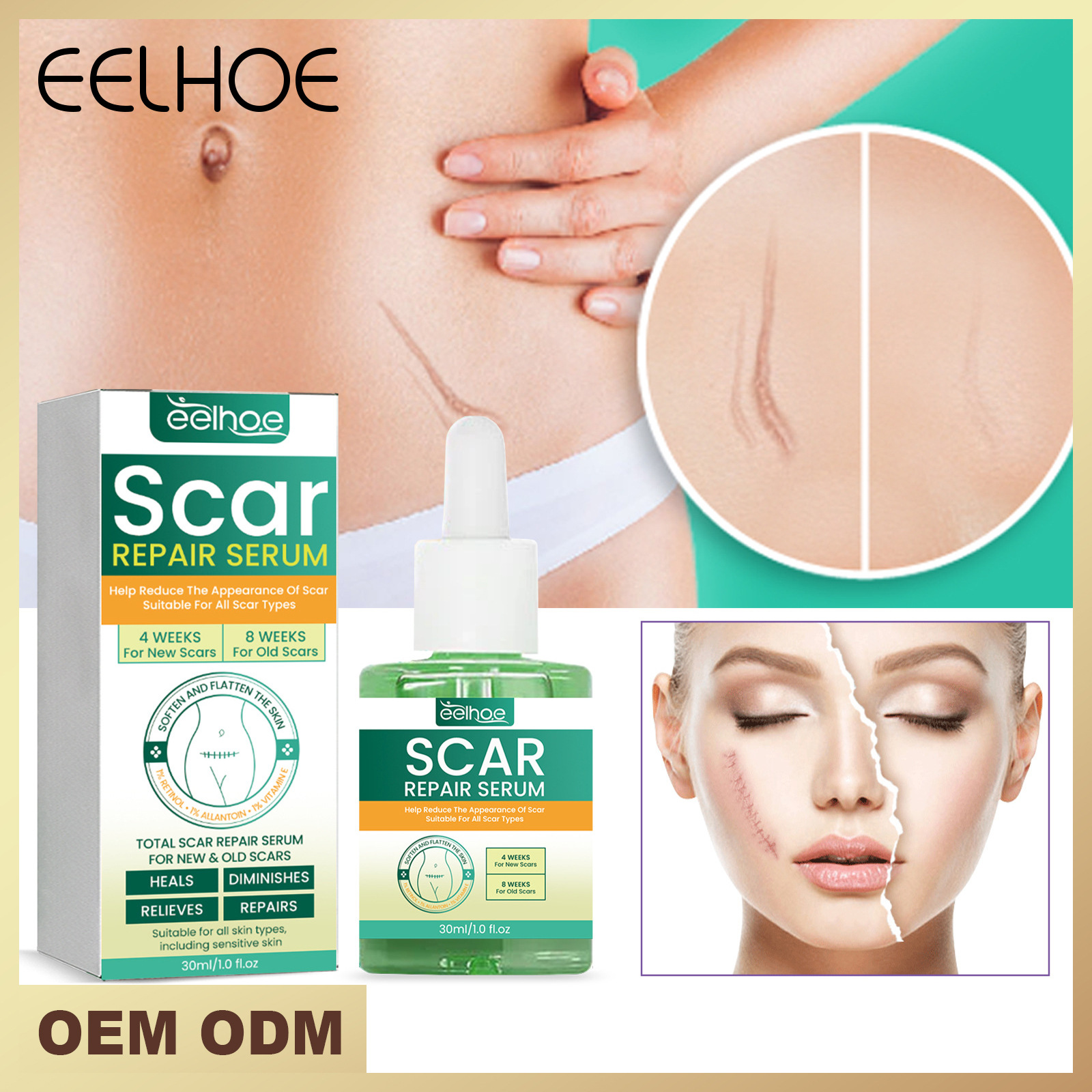 Réparation belle essence de cicatrice pour estomper la cicatrice cicatrice de grossesse lissage essence de soin de la peau_voghion.com