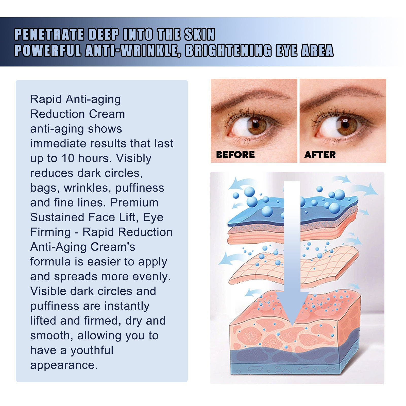 Rimpel Jaysuing Instant Resisting Eye Lifts, Sparren, Vervaagt Hoeken, Fijne Lijntjes, Reparaties en Hydrateert Anti A_voghion.com