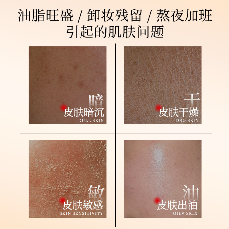 素秀臣氏层孔菌控油舒缓精华水乳补水保湿润肤控油水乳套装代发|undefined