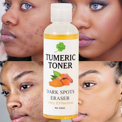 Dark spots eraser turmeric toner柔らかい肌の水が国境を越えて黒ウコン爽やかな肌の水を取り除く