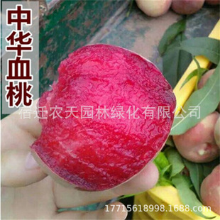 ���AѪ�����¼t�Ҙ�޽��������Ϸ������箔��Y�����Ҙ���ˮ����