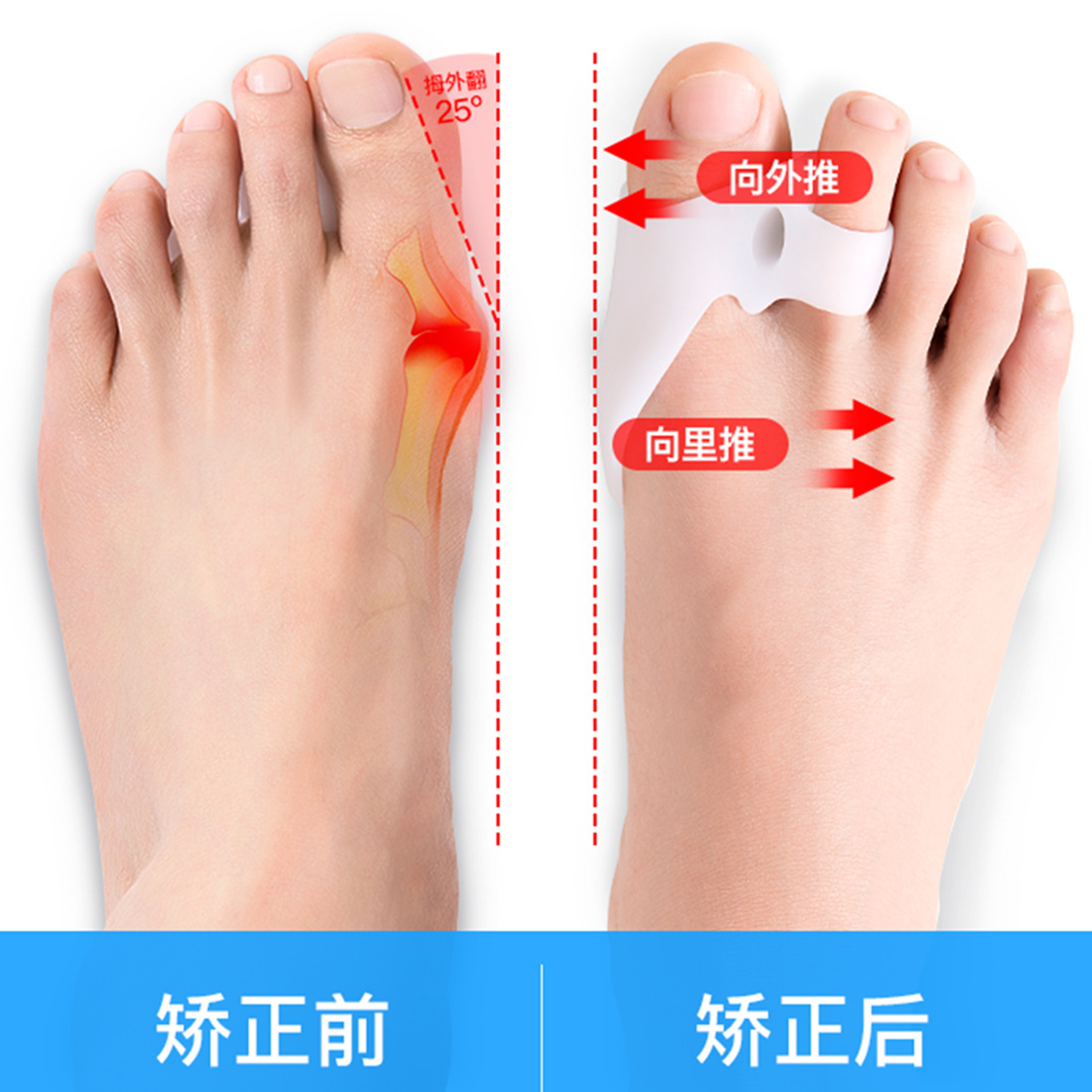 Silicone breathable elastic orthotics for toes