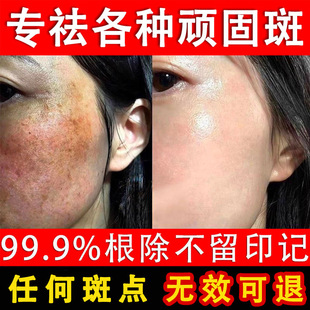 �������˪��Чը����˪��˪ȥ�S�ְ�ȸ�������ȥ��ɫ�����˪