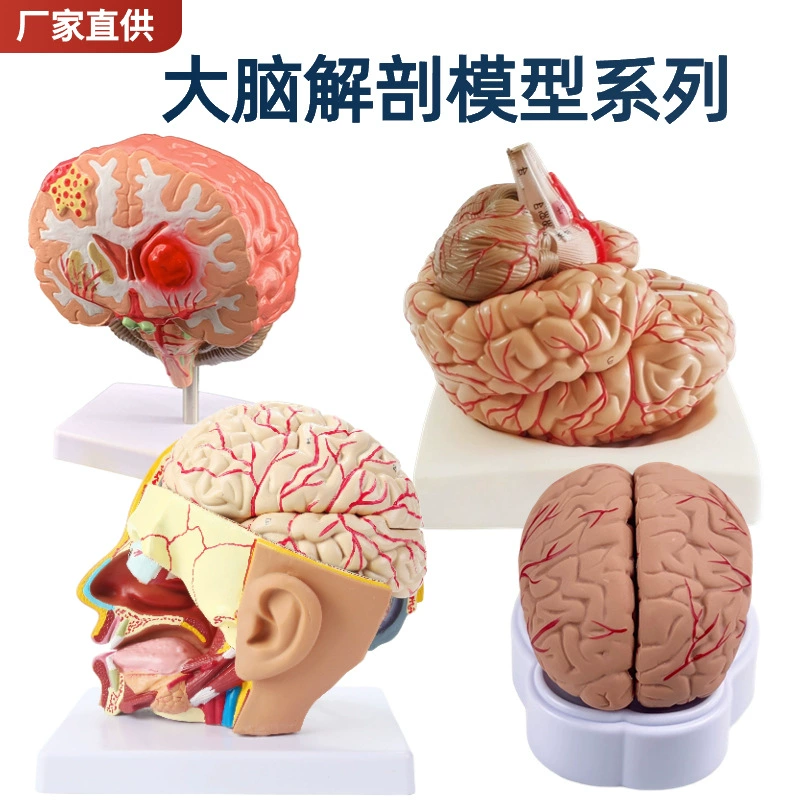 Brain model Brain function area color division model Human brain anatomy human cerebral artery structure cerebrovascular nerve