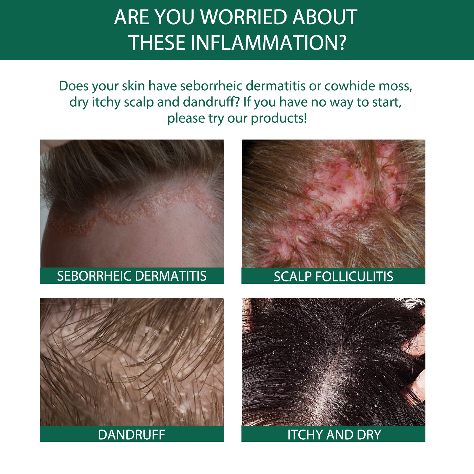 Dandruff Relief
