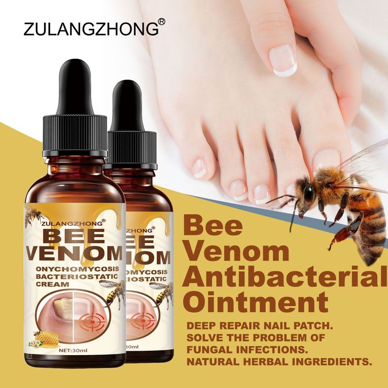 ZUALNGZHONG 跨境 外贸 灰指甲滴液 手足 指甲  灰指甲足部护理液|undefined