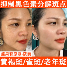 ܹԭҺȥSְȸƤɫ۰׾AҺ