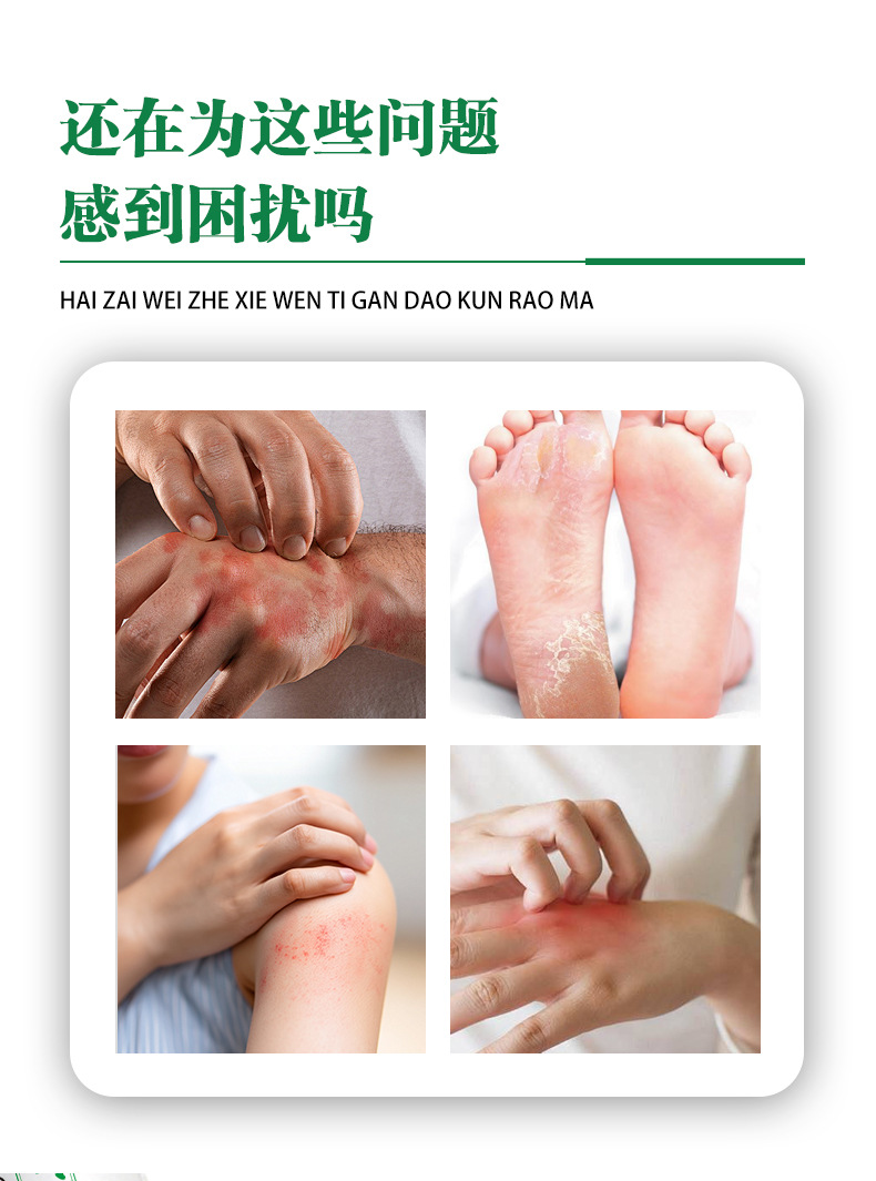 Yunnan Herbal Itch Relief Cream Yao Benren Skin Ointment 20g External Use quality and texture