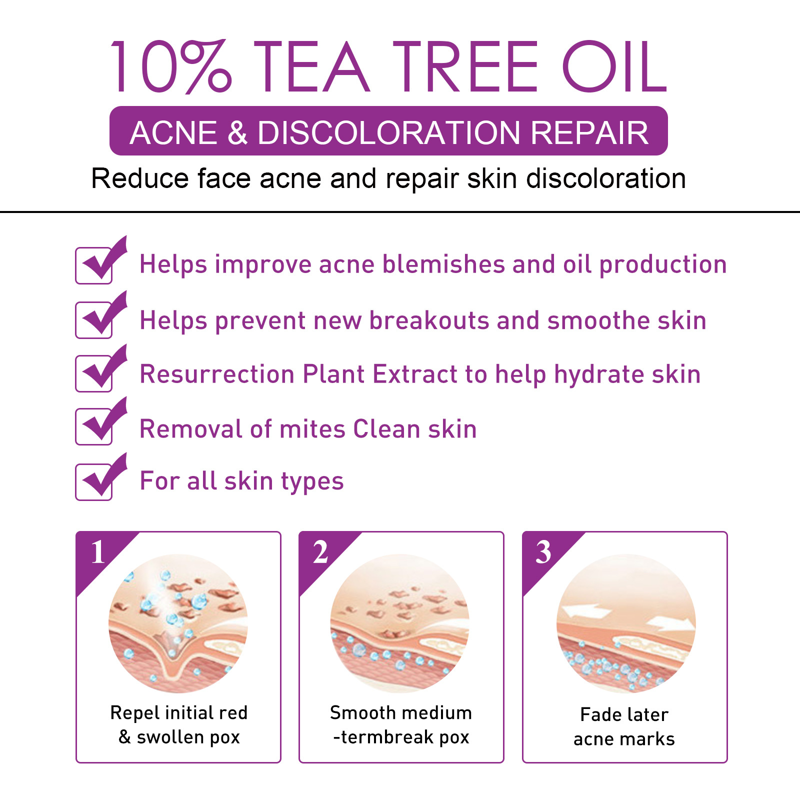 EELHOE Spot Lightening Whitening Cream mindert Akneflecken, repariert dunkle Flecken, spendet Feuchtigkeit, festigt und verbessert die Haut_voghion.com